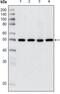 Histone Deacetylase 3 antibody, GTX83173, GeneTex, Western Blot image 