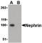 NPHS1 Adhesion Molecule, Nephrin antibody, LS-B1382, Lifespan Biosciences, Western Blot image 