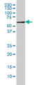 Interleukin-1 receptor-associated kinase-like 2 antibody, LS-B6102, Lifespan Biosciences, Western Blot image 