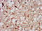 Protein Tyrosine Phosphatase Non-Receptor Type 13 antibody, LS-C671015, Lifespan Biosciences, Immunohistochemistry paraffin image 