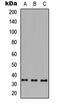 Melanoma-associated antigen 9 antibody, abx121514, Abbexa, Western Blot image 