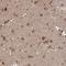 Threonine--tRNA ligase antibody, HPA066697, Atlas Antibodies, Immunohistochemistry paraffin image 