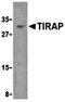 TIR Domain Containing Adaptor Protein antibody, orb74506, Biorbyt, Western Blot image 