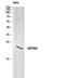 CKLF Like MARVEL Transmembrane Domain Containing 8 antibody, GTX34321, GeneTex, Western Blot image 