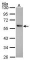 Aldehyde Dehydrogenase 1 Family Member A1 antibody, GTX100044, GeneTex, Western Blot image 