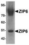 Solute Carrier Family 39 Member 6 antibody, LS-C115937, Lifespan Biosciences, Western Blot image 