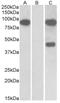 NUMB Like Endocytic Adaptor Protein antibody, AP32925PU-N, Origene, Western Blot image 