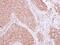 Siah E3 Ubiquitin Protein Ligase 1 antibody, NBP2-20356, Novus Biologicals, Immunohistochemistry frozen image 