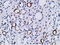Phosphoinositide 3-kinase adapter protein 1 antibody, M08114, Boster Biological Technology, Immunohistochemistry paraffin image 