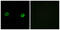 Abhydrolase Domain Containing 2 antibody, GTX87133, GeneTex, Immunocytochemistry image 