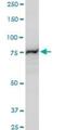 Proprotein Convertase Subtilisin/Kexin Type 6 antibody, H00005046-A01, Novus Biologicals, Western Blot image 