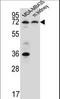 Purinergic Receptor P2X 7 antibody, LS-C163317, Lifespan Biosciences, Western Blot image 