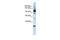 DIS3 Homolog, Exosome Endoribonuclease And 3'-5' Exoribonuclease antibody, GTX47314, GeneTex, Western Blot image 