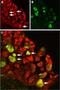 Transient Receptor Potential Cation Channel Subfamily V Member 1 antibody, PA5-77317, Invitrogen Antibodies, Immunohistochemistry paraffin image 