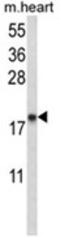 Natriuretic Peptide A antibody, AP18139PU-N, Origene, Western Blot image 