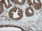 Crystallin Alpha A antibody, LS-C787720, Lifespan Biosciences, Immunohistochemistry paraffin image 