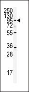 ADAMTS13 antibody, LS-C100639, Lifespan Biosciences, Western Blot image 