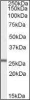 Glutathione Peroxidase 3 antibody, orb88659, Biorbyt, Western Blot image 
