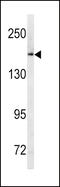 ATP Binding Cassette Subfamily C Member 1 antibody, 62-353, ProSci, Western Blot image 