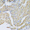 Corticotropin Releasing Hormone Binding Protein antibody, 22-319, ProSci, Immunohistochemistry frozen image 