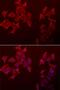 Chondromodulin antibody, PA5-76974, Invitrogen Antibodies, Immunofluorescence image 