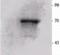 Ribosomal Protein S6 Kinase B1 antibody, LS-C210645, Lifespan Biosciences, Western Blot image 