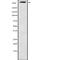 Mucin 16, Cell Surface Associated antibody, abx216976, Abbexa, Western Blot image 