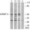 Heterogeneous Nuclear Ribonucleoprotein H2 antibody, A07741, Boster Biological Technology, Western Blot image 