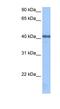 Apolipoprotein B MRNA Editing Enzyme Catalytic Subunit 3F antibody, NBP1-57372, Novus Biologicals, Western Blot image 