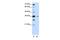 DAZ Associated Protein 1 antibody, GTX47199, GeneTex, Western Blot image 