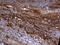 Podoplanin antibody, M01124-3, Boster Biological Technology, Immunohistochemistry paraffin image 