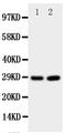 PRP antibody, PA1795, Boster Biological Technology, Western Blot image 