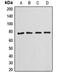 Annexin A6 antibody, LS-C351823, Lifespan Biosciences, Western Blot image 