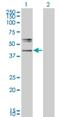 UDP-GlcNAc:BetaGal Beta-1,3-N-Acetylglucosaminyltransferase 2 antibody, H00010678-M05, Novus Biologicals, Western Blot image 