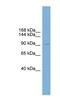 Polyhomeotic Homolog 2 antibody, NBP1-79447, Novus Biologicals, Western Blot image 