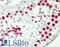 DNA Topoisomerase II Alpha antibody, LS-C797992, Lifespan Biosciences, Immunohistochemistry paraffin image 