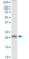 RAB13, Member RAS Oncogene Family antibody, H00005872-M01, Novus Biologicals, Western Blot image 