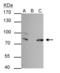 Far Upstream Element Binding Protein 1 antibody, GTX104579, GeneTex, Immunoprecipitation image 