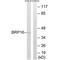 HGH1 Homolog antibody, PA5-49992, Invitrogen Antibodies, Western Blot image 
