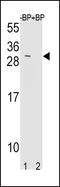 TIMP Metallopeptidase Inhibitor 3 antibody, 63-791, ProSci, Western Blot image 