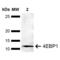 Eukaryotic Translation Initiation Factor 4E Binding Protein 1 antibody, LS-C774412, Lifespan Biosciences, Western Blot image 