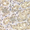 Proteasome 26S Subunit, Non-ATPase 12 antibody, A6708, ABclonal Technology, Immunohistochemistry paraffin image 