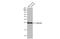 Calbindin 1 antibody, GTX634833, GeneTex, Western Blot image 