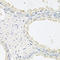 Erythropoietin Receptor antibody, LS-C332289, Lifespan Biosciences, Immunohistochemistry paraffin image 