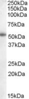 Cytochrome P450 Family 19 Subfamily A Member 1 antibody, EB08329, Everest Biotech, Western Blot image 