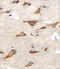 Isocitrate Dehydrogenase (NAD(+)) 3 Beta antibody, A09433-2, Boster Biological Technology, Immunohistochemistry paraffin image 
