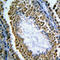 Minichromosome Maintenance Complex Component 3 Associated Protein antibody, GTX55906, GeneTex, Immunohistochemistry paraffin image 