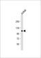 Phosphatidylinositol-4,5-Bisphosphate 3-Kinase Catalytic Subunit Gamma antibody, 63-449, ProSci, Western Blot image 