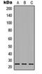 Orosomucoid 1 antibody, orb234933, Biorbyt, Western Blot image 