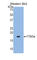 Retinoic Acid Receptor Responder 2 antibody, abx100232, Abbexa, Western Blot image 